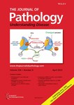 Journal Of Pathology